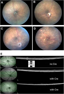 Retinal Development and Pathophysiology in Kcnj13 Knockout Mice